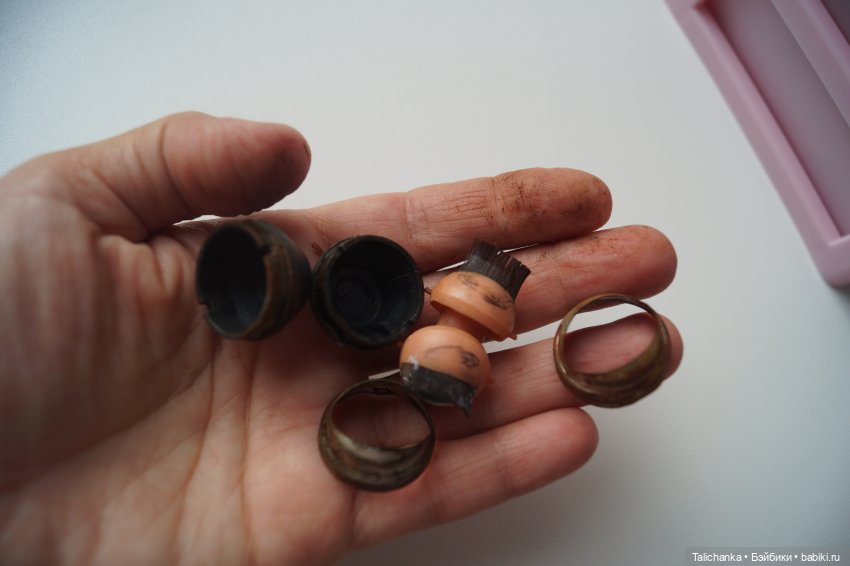 Третья выписка августа. Нейрохирург вылечил малюток. Вправляем тазобедренный вывих. Базироним гематомы и ссадины