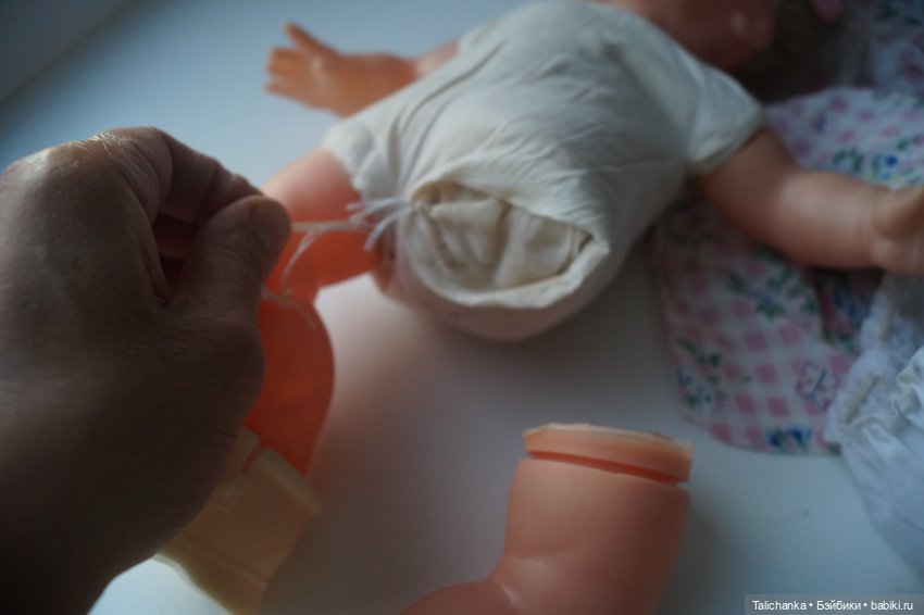 Третья выписка августа. Нейрохирург вылечил малюток. Вправляем тазобедренный вывих. Базироним гематомы и ссадины