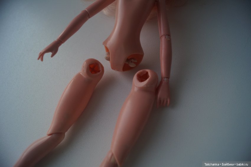 Третья выписка августа. Нейрохирург вылечил малюток. Вправляем тазобедренный вывих. Базироним гематомы и ссадины