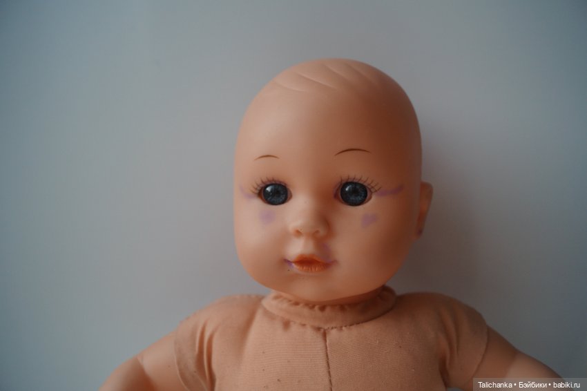 Четвёртая выписка августа. Вправляем перелом руки. Базироним пятна. Две перепрошивки