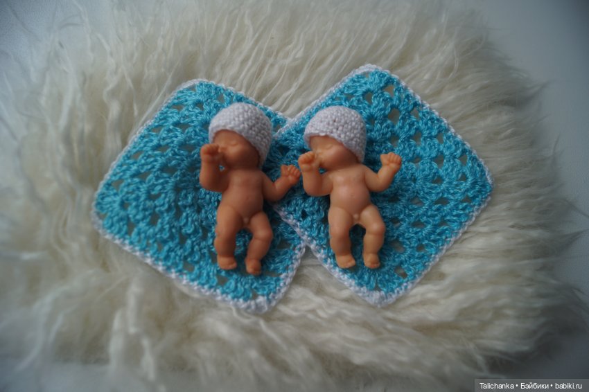 Четвёртая выписка августа. Вправляем перелом руки. Базироним пятна. Две перепрошивки