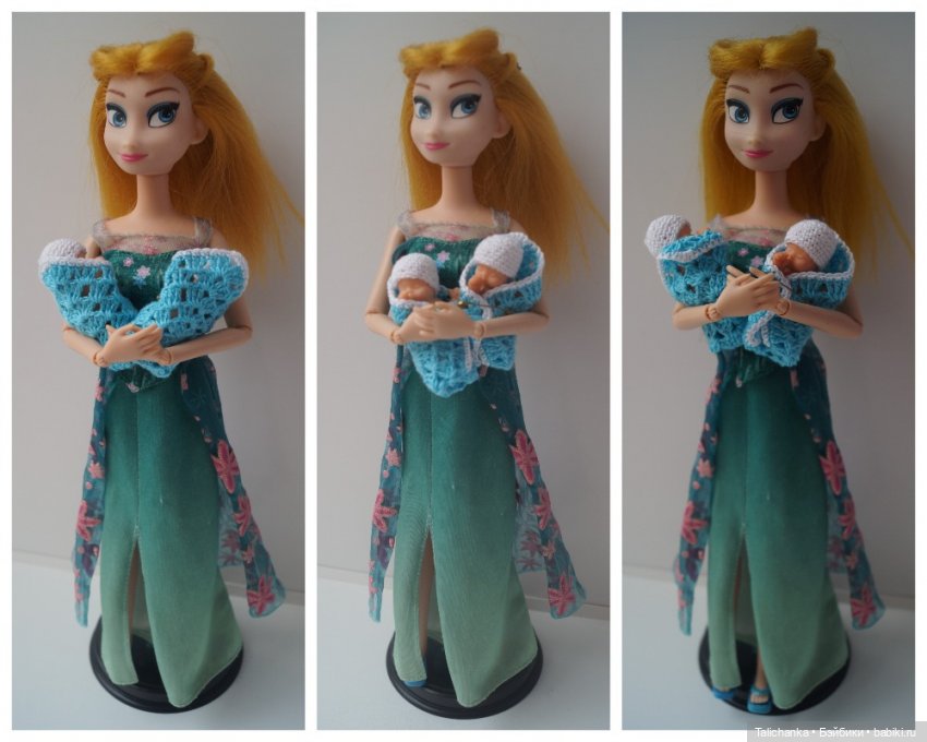 Четвёртая выписка августа. Вправляем перелом руки. Базироним пятна. Две перепрошивки