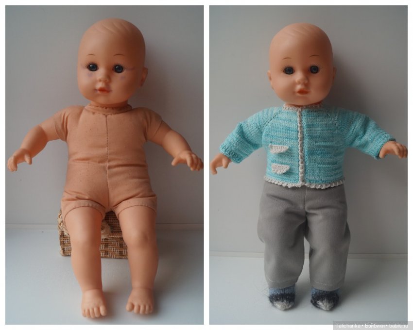 Четвёртая выписка августа. Вправляем перелом руки. Базироним пятна. Две перепрошивки