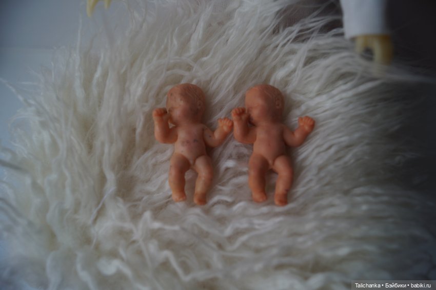 Четвёртая выписка августа. Вправляем перелом руки. Базироним пятна. Две перепрошивки