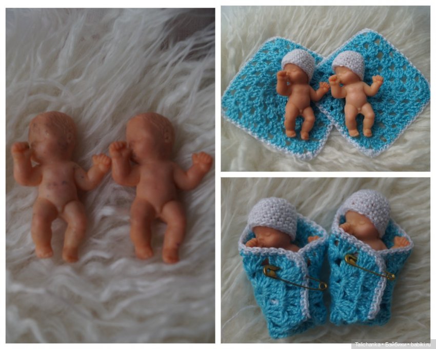 Четвёртая выписка августа. Вправляем перелом руки. Базироним пятна. Две перепрошивки