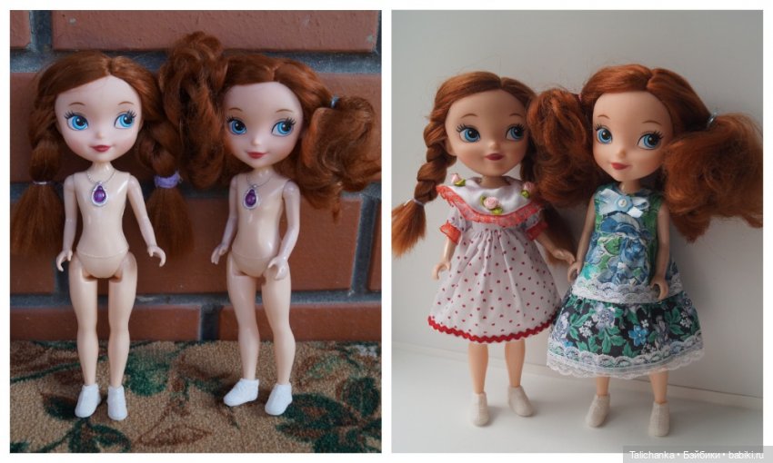 Четвёртая выписка августа. Вправляем перелом руки. Базироним пятна. Две перепрошивки