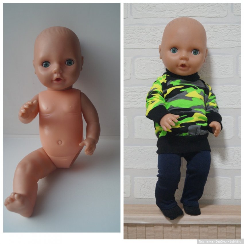 Третья выписка сентября. Рождение Телепузика. Новое тело для малышки. Нейрохирург лечит Белль