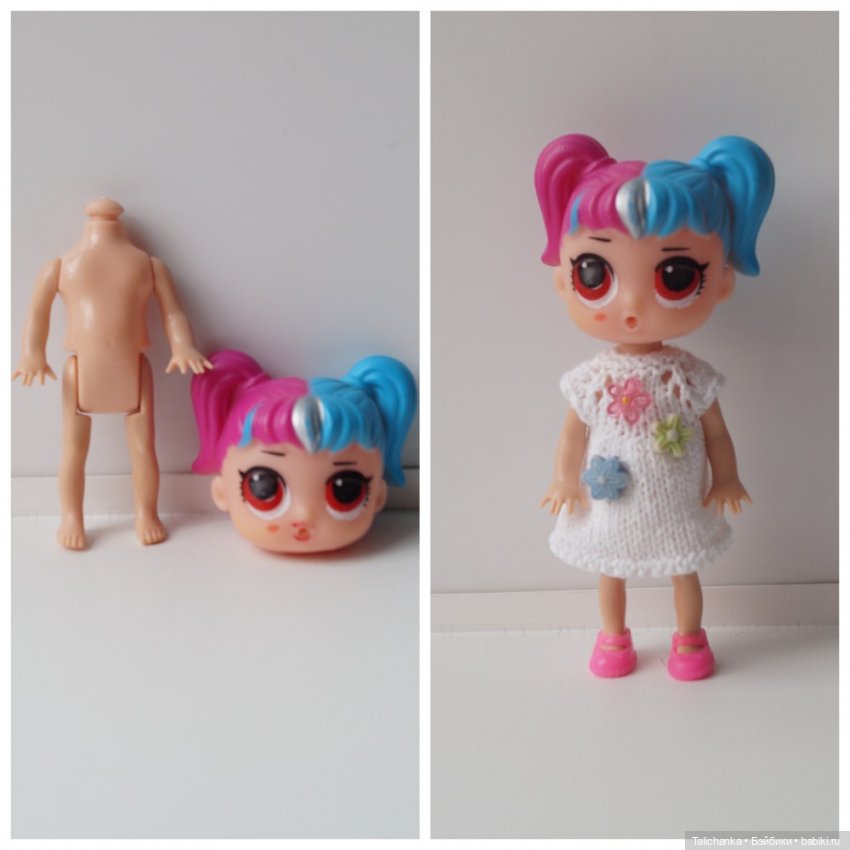 Третья выписка апреля паяем разрыв на плечах Паяем ножку Восстанавливаем кудряшки Нейрохируг лечил малышку