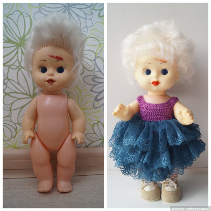 Третья выписка апреля паяем разрыв на плечах Паяем ножку Восстанавливаем кудряшки Нейрохируг лечил малышку