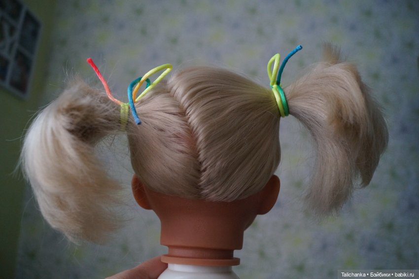 Вторая выписка января Борис Анатольевич заменяет нейрохирурга Возвращаем Мишуткам зрение и краски ГДРочка обрела зрение