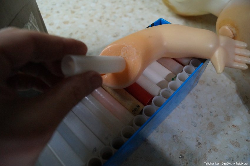 Первая выписка февраля: Выздоровление Димы 8 марта. Две прошивки и четыре ремонта шейных креплений (фото 10)