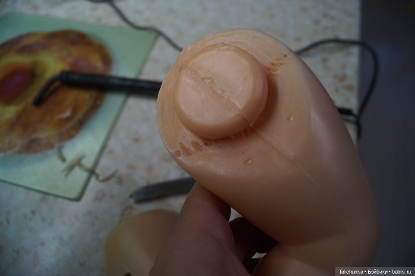 Первая выписка февраля: Выздоровление Димы 8 марта. Две прошивки и четыре ремонта шейных креплений (фото 8)