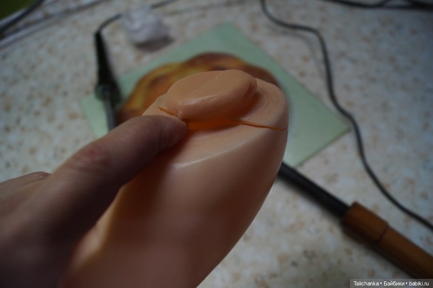 Первая выписка февраля: Выздоровление Димы 8 марта. Две прошивки и четыре ремонта шейных креплений (фото 7)