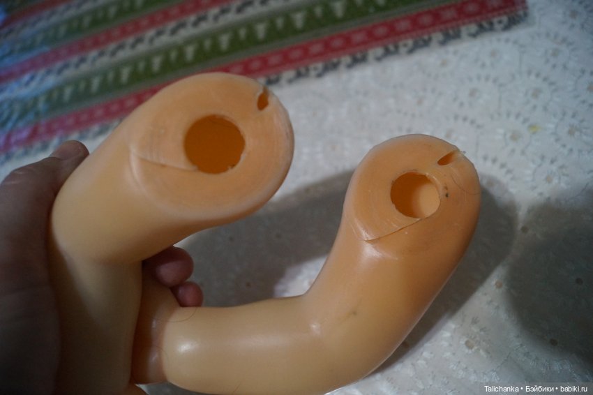 Первая выписка февраля: Выздоровление Димы 8 марта. Две прошивки и четыре ремонта шейных креплений (фото 5)