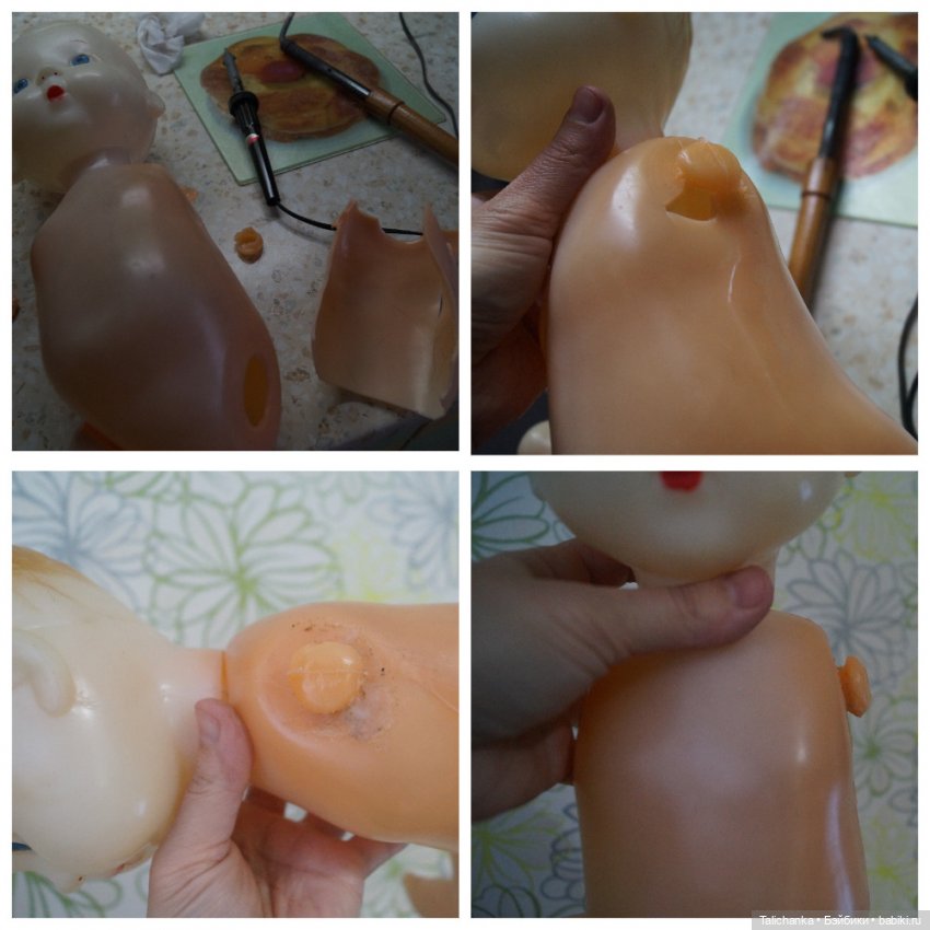 Первая выписка февраля: Выздоровление Димы 8 марта. Две прошивки и четыре ремонта шейных креплений (фото 4)