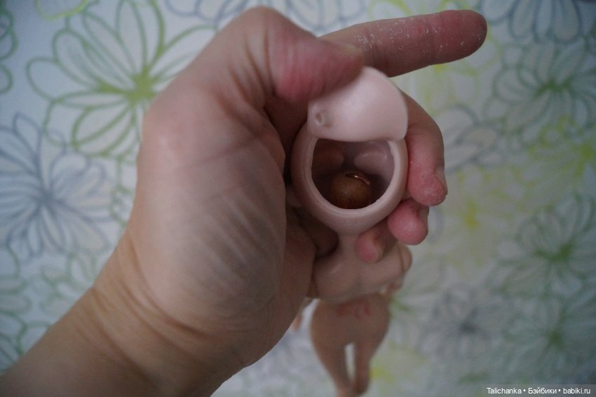 Первая выписка февраля: Выздоровление Димы 8 марта. Две прошивки и четыре ремонта шейных креплений