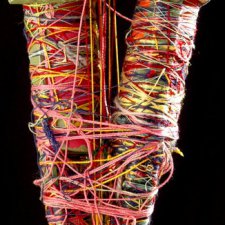 Джудит и Джойс Скотт-"неправильные близнецы"...