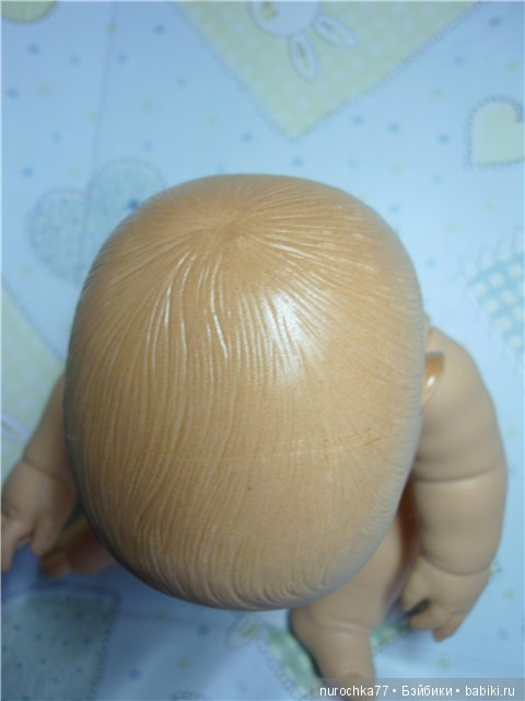 Записки реаниматора: жертвы Племяшки (фото 9)