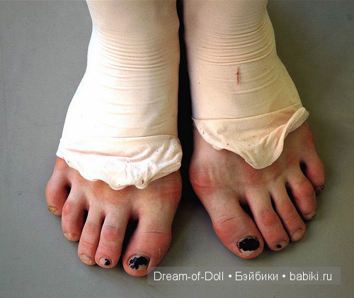 Ноги Балерины Фото После Танцев