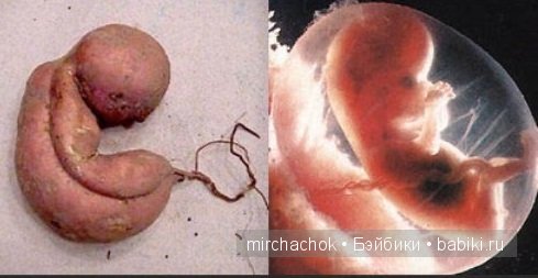 НЕ забавные сходства — Болталка и разговоры обо всем: жизнь (фото 2)