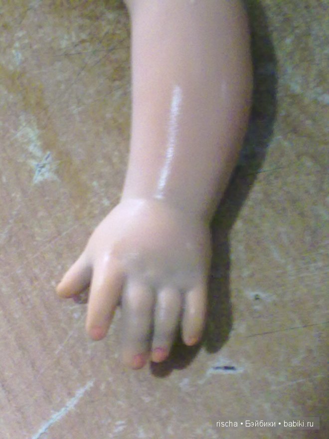 Повесть о том, как я лечила черные пятна у немки (фото 5)