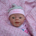 Молд  с синдромом Дауна