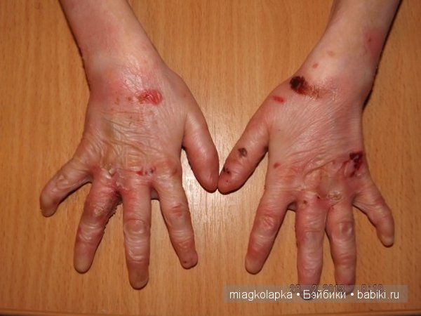 МАЛЬЧИК-БАБОЧКА.ОЧЕНЬ НУЖНА ЛЮБАЯ ПОМОЩЬ!ПОЖАЛУЙСТА НЕ ПРОХОДИТЕ МИМО (фото 3)