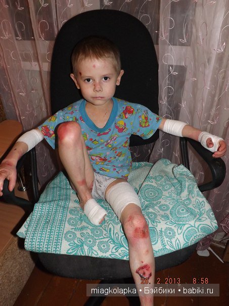 МАЛЬЧИК-БАБОЧКА.ОЧЕНЬ НУЖНА ЛЮБАЯ ПОМОЩЬ!ПОЖАЛУЙСТА НЕ ПРОХОДИТЕ МИМО (фото 2)