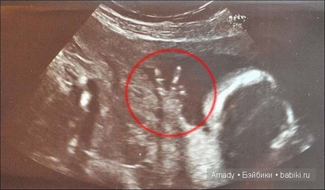 Позитив. Самые добрые и забавные фотографии для поднятия настроения | Бэйбики Позитив. Самые добрые и забавные фотографии для поднятия настроения