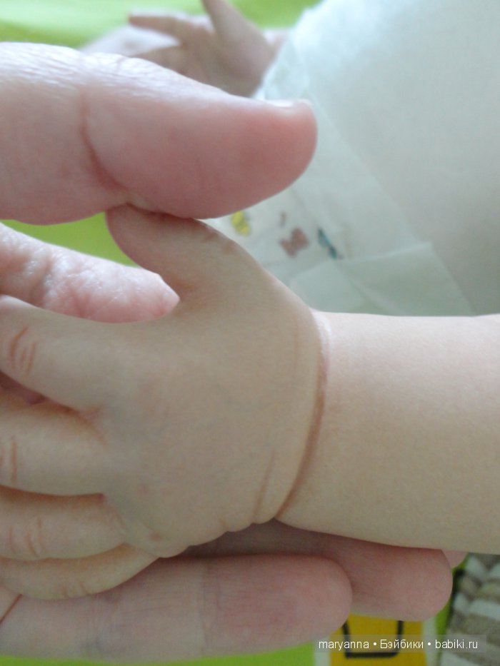 складочки на ручке