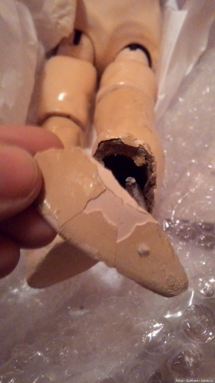 отвалившаяся стопа