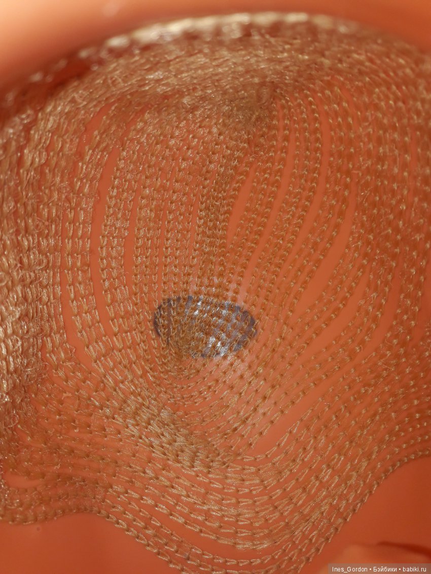 почернение у немок