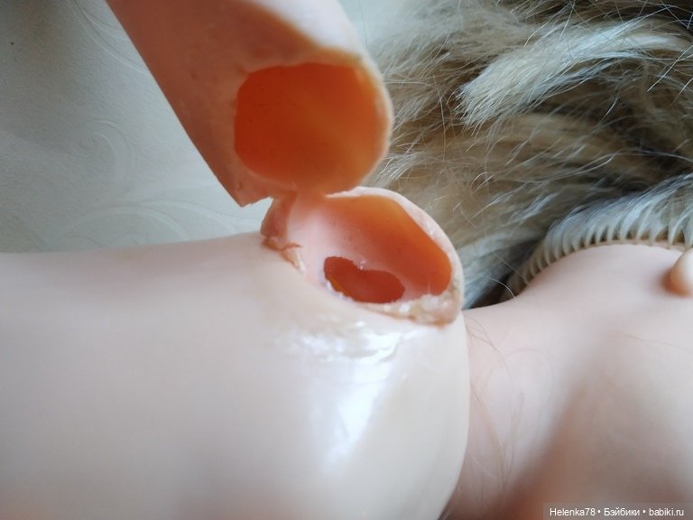 А куклы как люди. Один диагноз может лечится по-разному. Ремонт резиновой руки (фото 2)