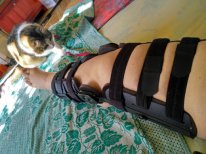 Замена шарнира у Азон XS — Куклы Takara Tomy (Такара): Licca (Ликка)