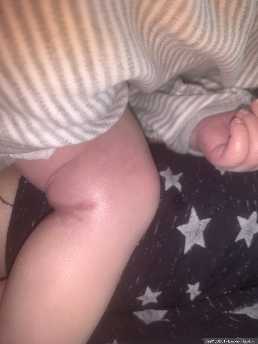 Как отреставрировать куклу реборн/ приехала в ужасном состоянии (фото 3)