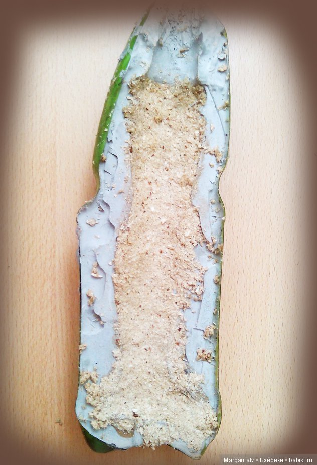 Спасение безноженьки. Часть 2. Хирургия и трансплантация (фото 9)