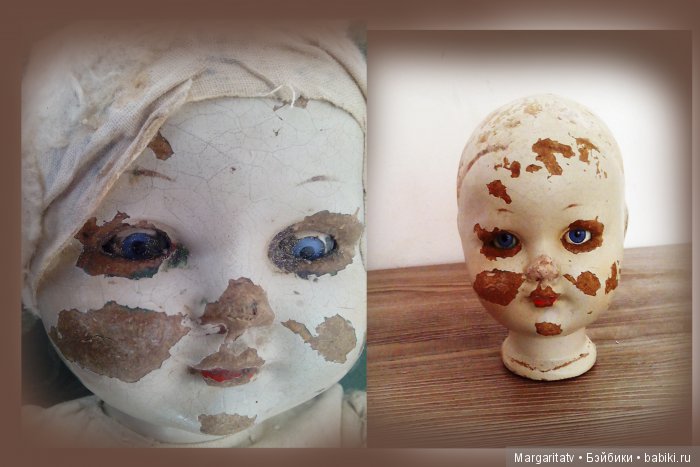 Спасение безноженьки. Часть 2. Хирургия и трансплантация