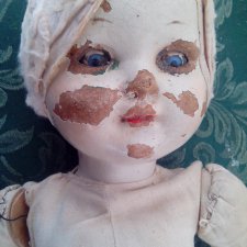 Спасение безноженьки. Часть 3. Врачебные ошибки и неудачи