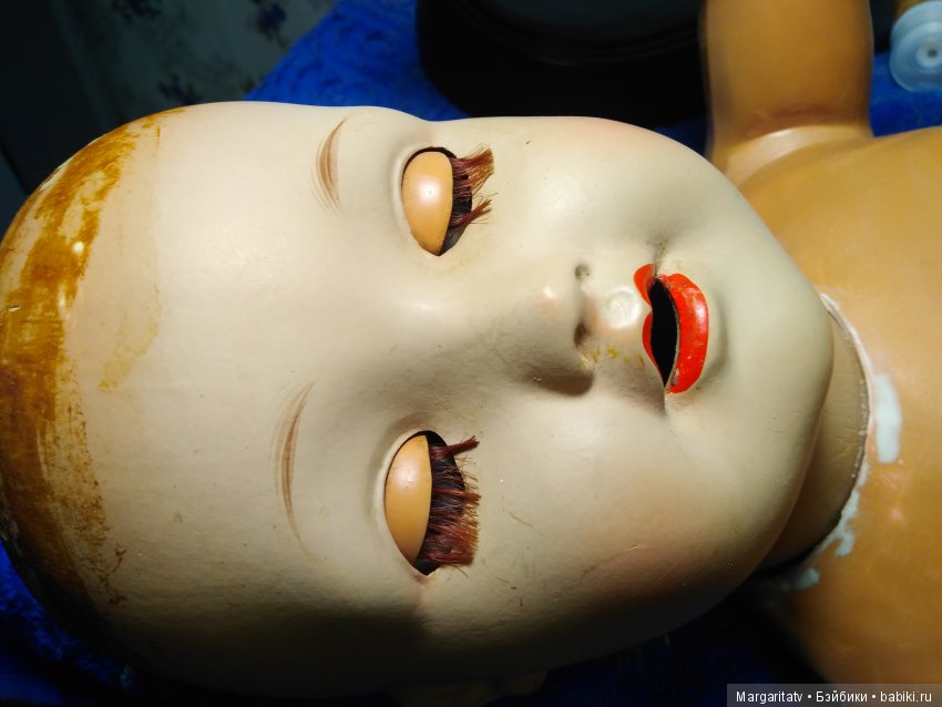 Лечение куколки фабрики Зонненберг