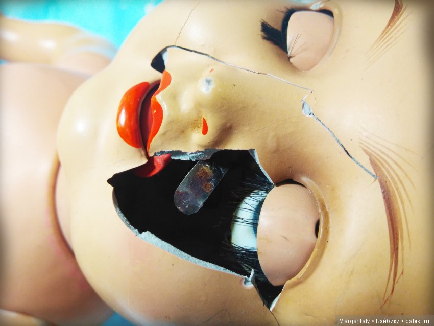 Челюстно - лицевая хирургия для куколки Франца Шмидта (фото 3)