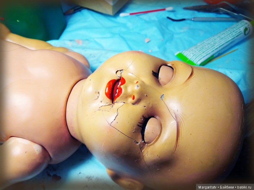 Челюстно - лицевая хирургия для куколки Франца Шмидта