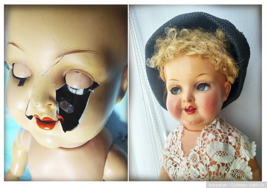 Челюстно - лицевая хирургия для куколки Франца Шмидта