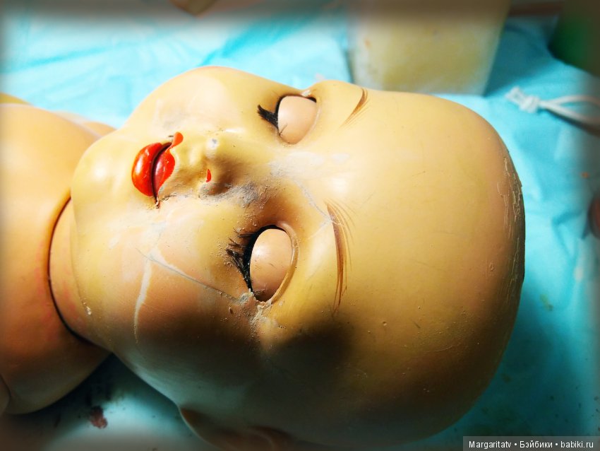 Челюстно - лицевая хирургия для куколки Франца Шмидта