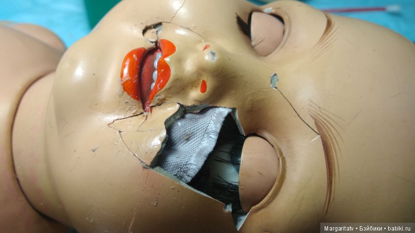 Челюстно - лицевая хирургия для куколки Франца Шмидта (фото 10)