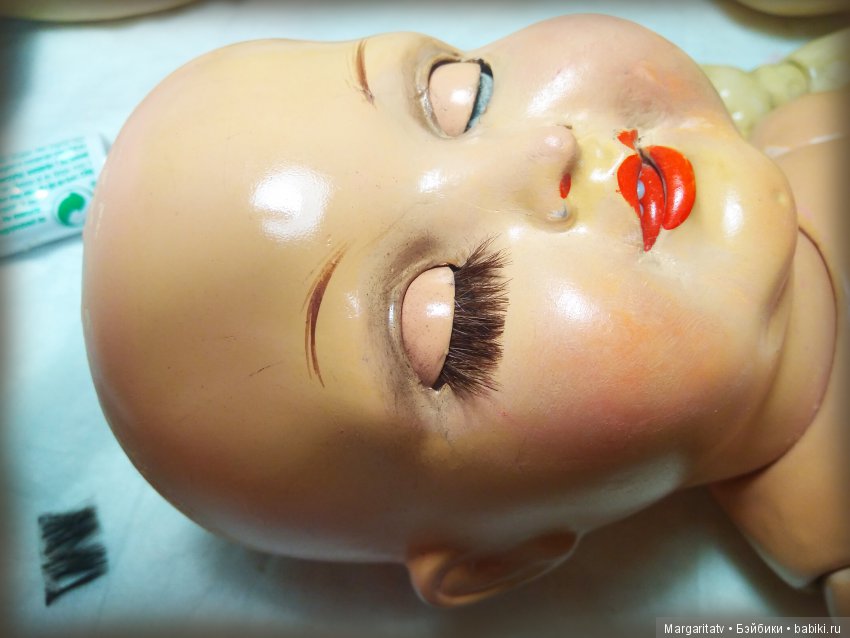 Челюстно - лицевая хирургия для куколки Франца Шмидта