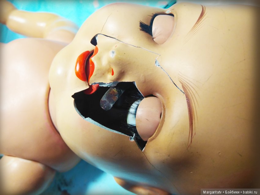 Челюстно - лицевая хирургия для куколки Франца Шмидта (фото 2)