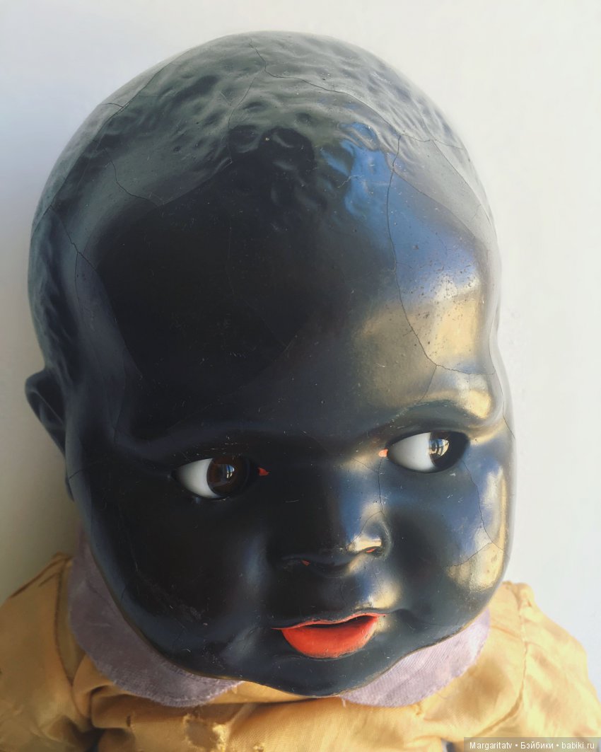 Лечение ножки темнокожего малыша (фото 3)