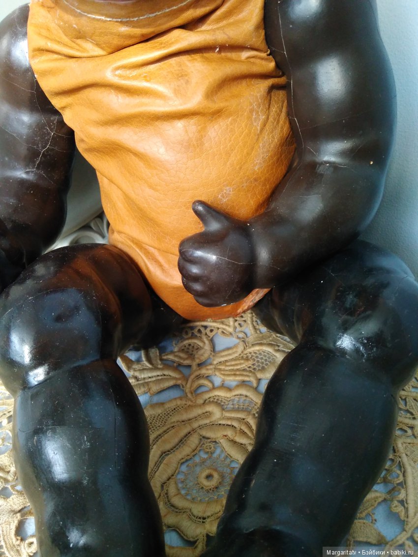 Лечение ножки темнокожего малыша