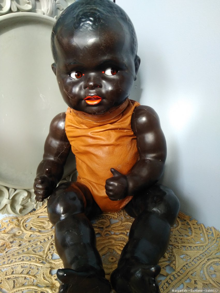 Лечение ножки темнокожего малыша