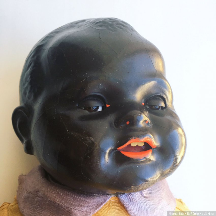 Лечение ножки темнокожего малыша (фото 2)